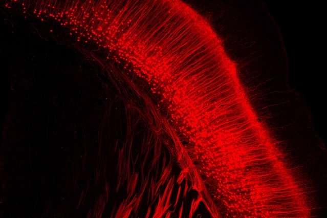 Viral tool traces long-term neuron activity