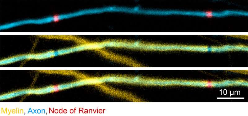 观看Myelin模式表格：体内成像显示鞘重塑的证据