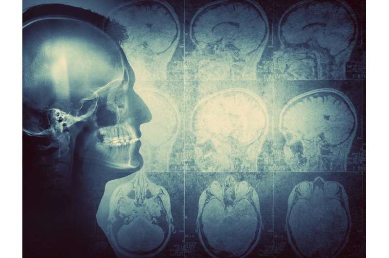 When the body attacks the brain: Immune system often to blame for encephalitis, study finds