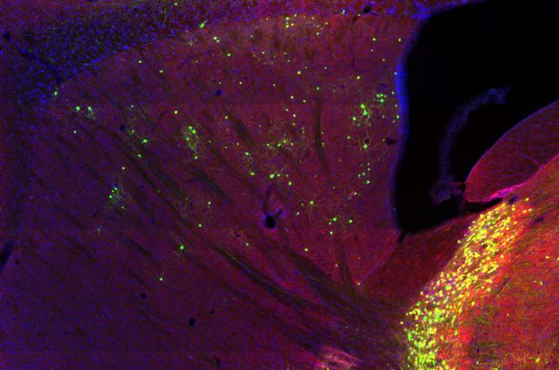 Where brain cells get their information may determine their roles in diseases