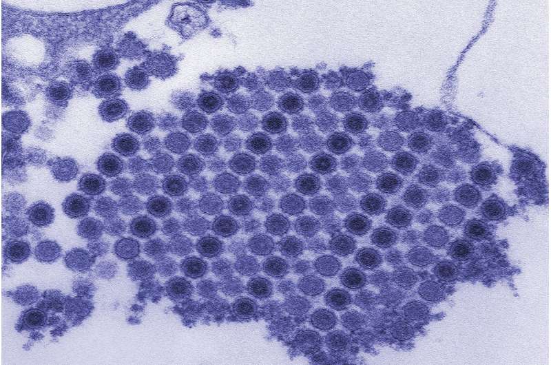 Why chikungunya, other arthritis-causing viruses target joints