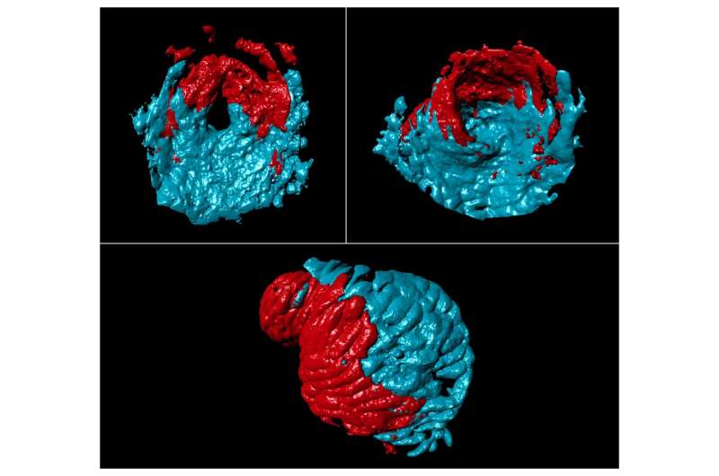 Zebrafish heart development reveals key insight into inherited heart defects