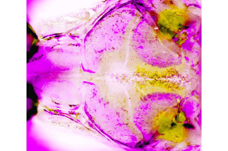 Zebrafish make waves in our understanding of a common craniofacial birth defect