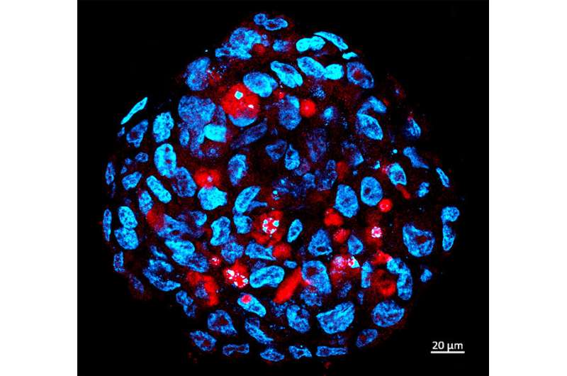 Zika virus eliminates advanced human tumor in central nervous system of rodents