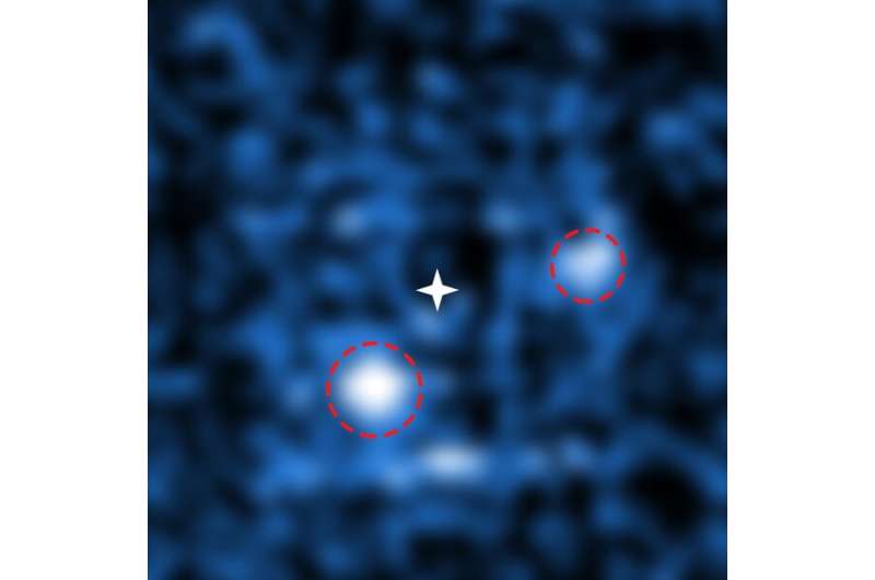 A pair of fledgling planets directly seen growing around a young star