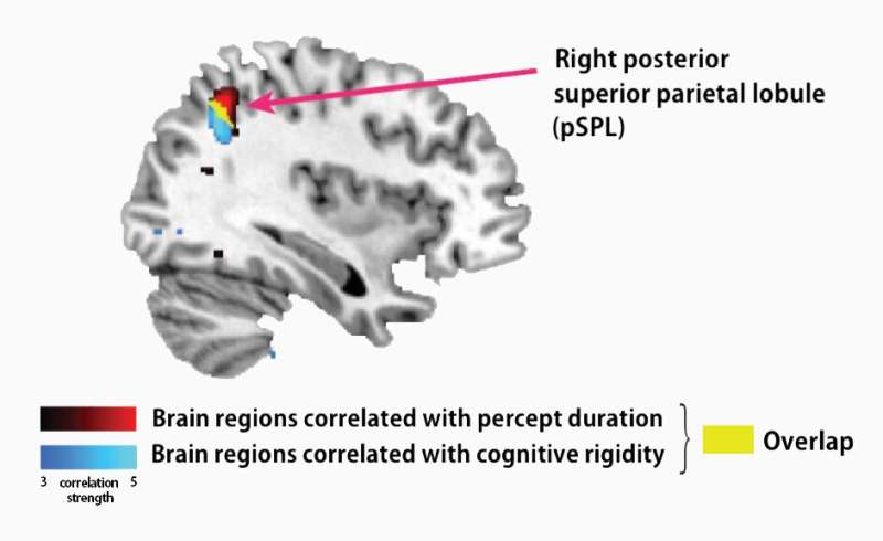 Brain anatomy links cognitive and perceptual symptoms in autism