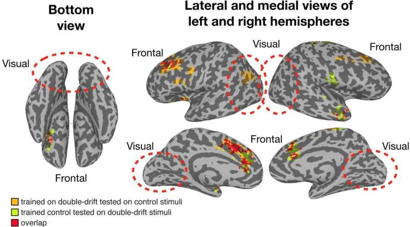 Dartmouth study finds conscious visual perception occurs outside the visual system