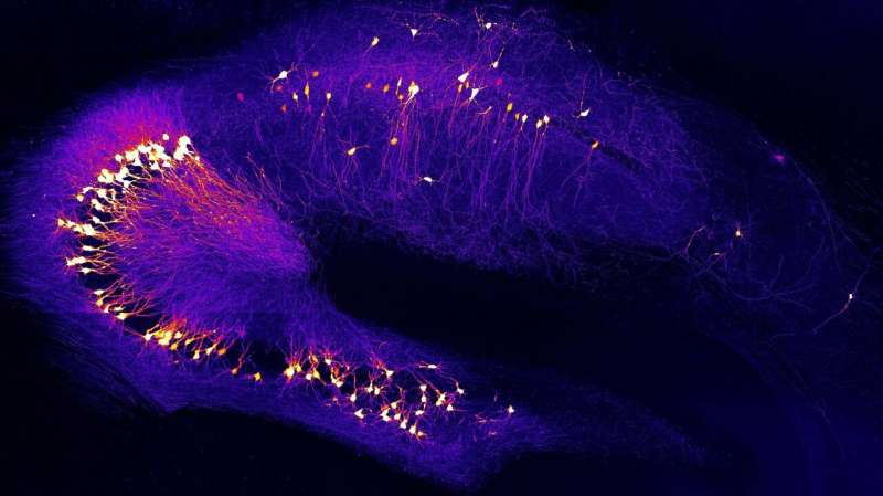 Direct toxic action of beta-amyloid identified