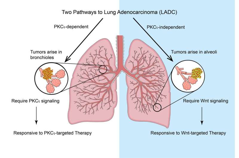 Discovery of distinct lung cancer pathways may lead to more targeted treatments
