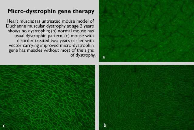 Gene therapy cassettes improved for muscular dystrophy