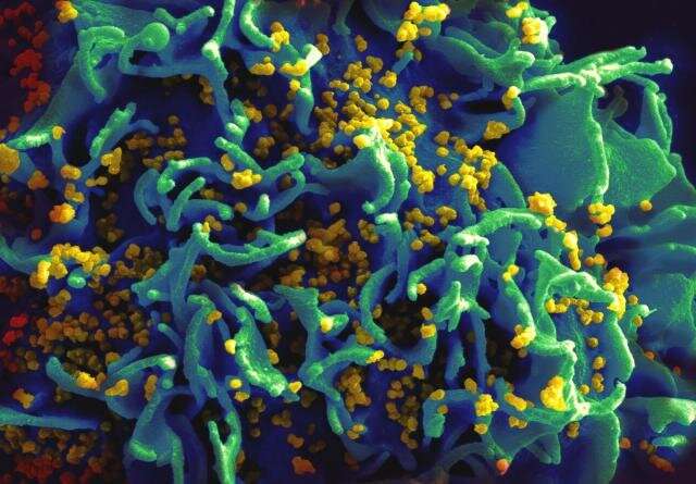 Gut microbiome may contribute to HIV transmission in high-risk men