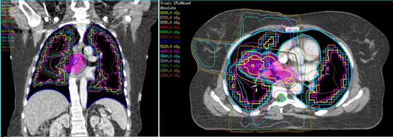 How CT scans continue to play a fundamental role in cancer treatment