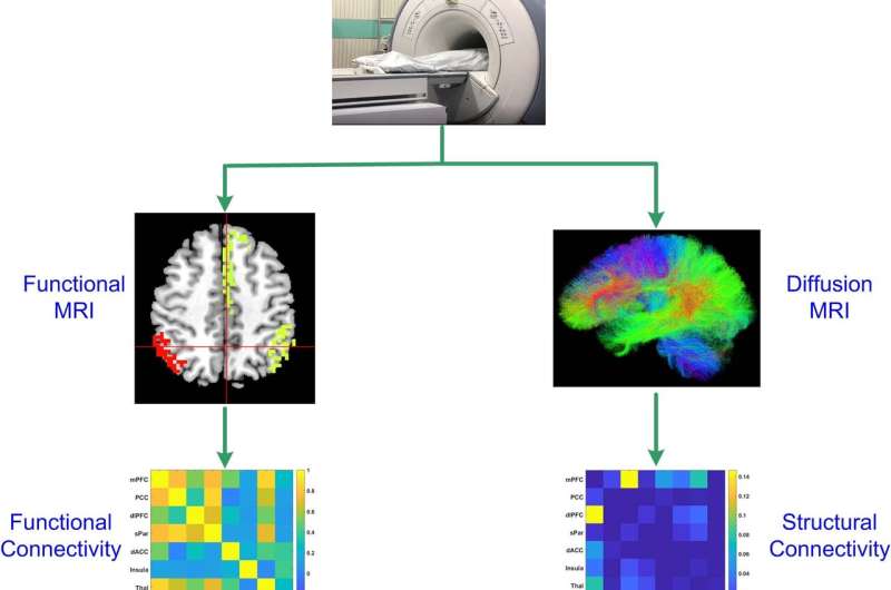 Imaging reveals pathways behind depression