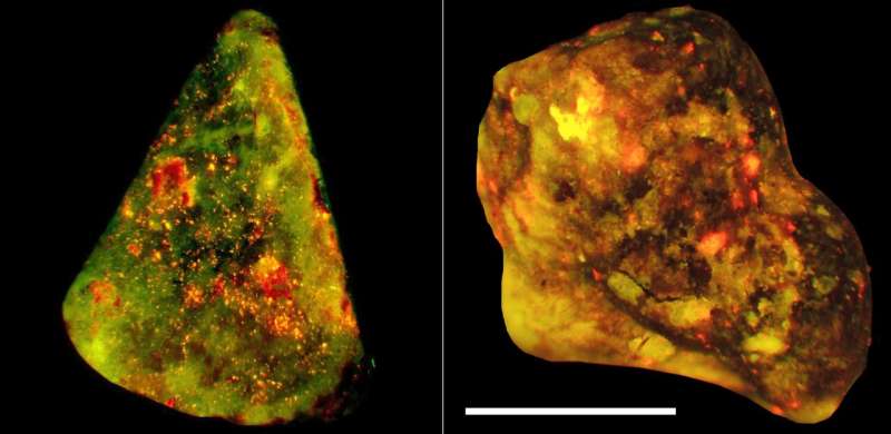 Immune cells drive gallstone formation