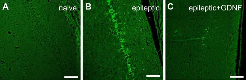 Implantable device curbs seizures and improves cognition in epileptic rats