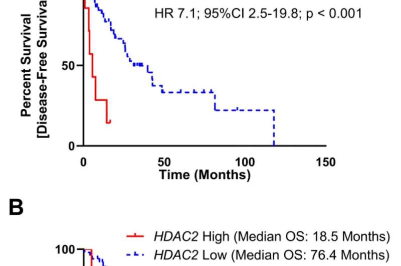 Inhibition of histone deacetylase 2 reduces MDM2 expression and reduces tumor growth in dedifferentiated liposarcoma