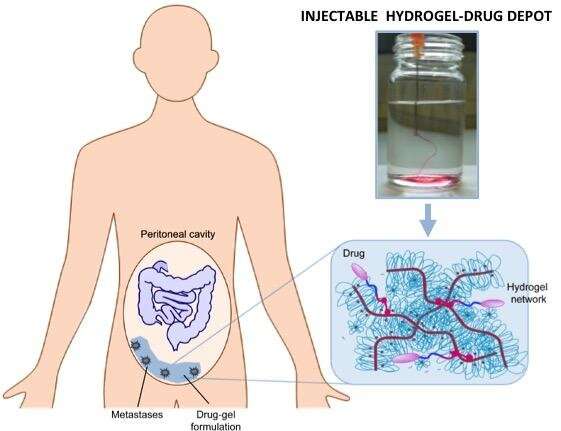 Injectable ‘chemo gel’ is possible alternative to abdominal rinses in abdominal cancer.