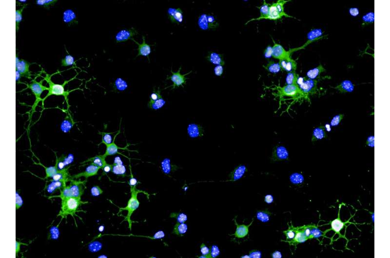 Multiple sclerosis -- Helping cells to help themselves