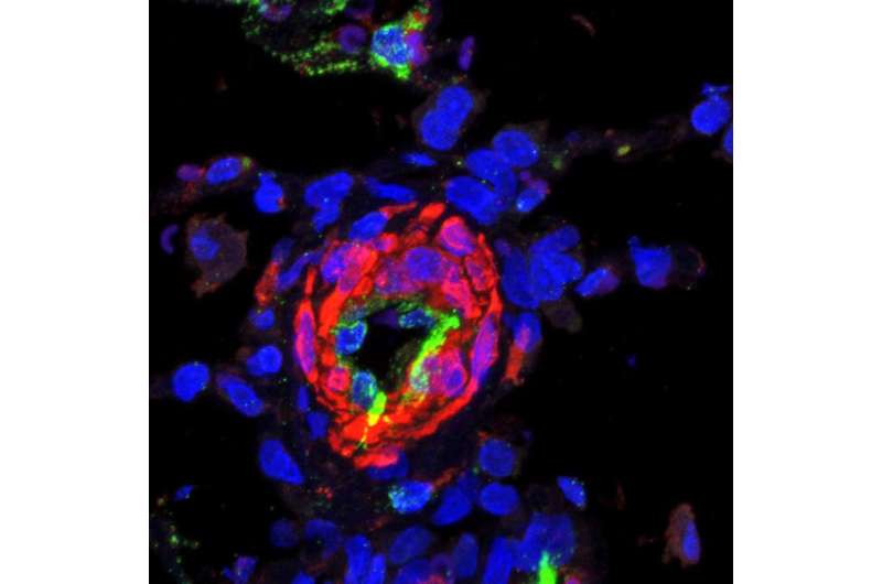 New drug target discovered for the lung disease PAH