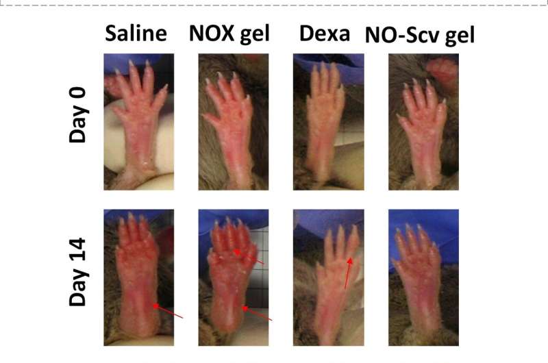 Nitric oxide-scavenging hydrogel developed for rheumatoid arthritis treatment