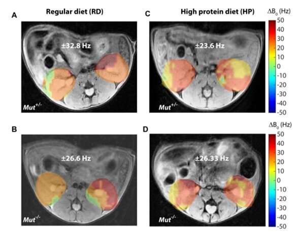 Noninvasive monitoring of chronic kidney disease (CKD) using pH and perfusion imaging