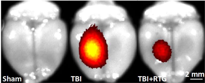 Novel therapy administered after TBI prevents brain damage