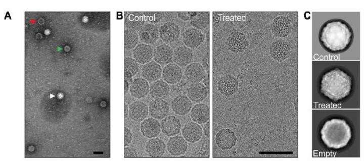 Physiological mechanisms leading to enterovirus opening revealed – helps in developing therapeutic treatments