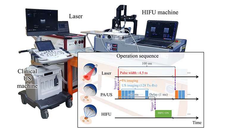 Real-time photoacoustic thermometry of tumors during HIFU treatment in living subjects