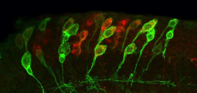 Research sheds new light on how brain stem cells are activated