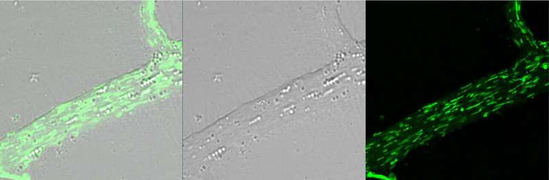 Sea slug study illuminates how mitochondria move