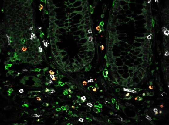Single-cell atlas reveals underlying building blocks of ulcerative colitis