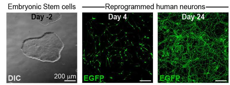 Stem cells reprogrammed into neurons could reveal drugs harmful to pregnancy