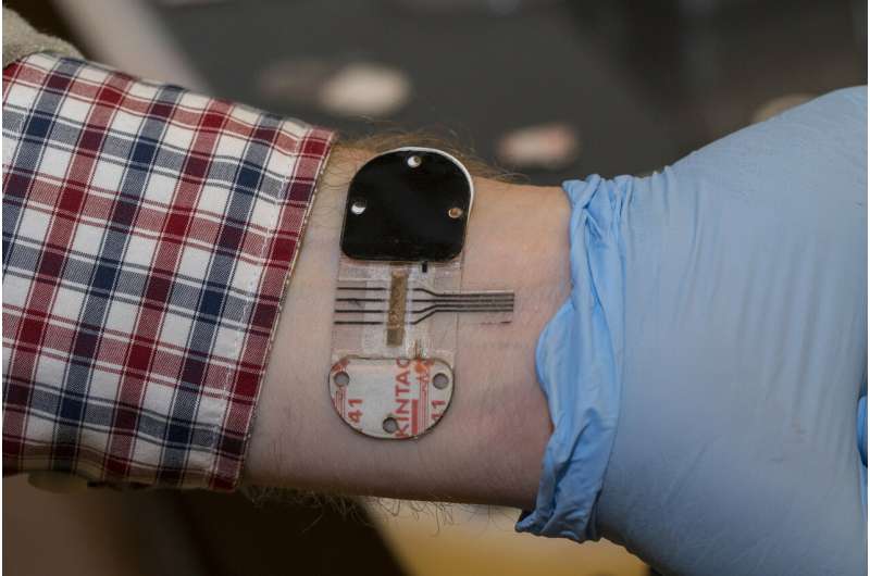 Sweat holds most promise for noninvasive testing
