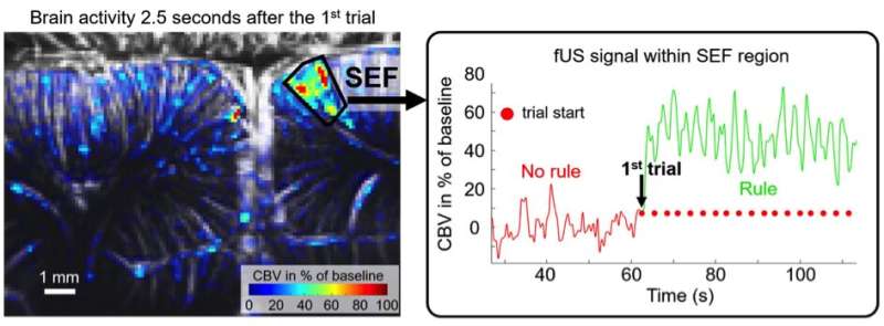 Tracking the flow of thoughts using ultrafast ultrasound