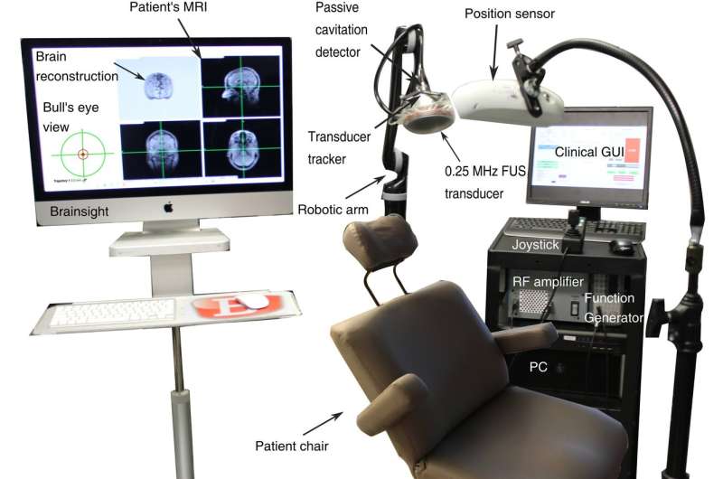 Ultrasound method restores dopaminergic pathway in brain at Parkinson's early stages