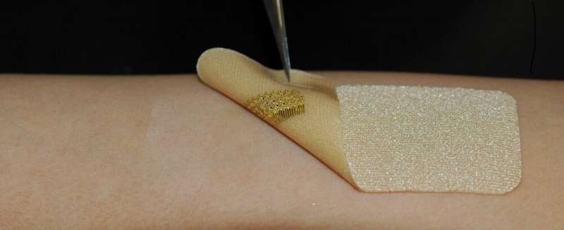 Wearable sensors mimic skin to help with wound healing process