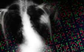 ZEB1 throttles therapeutic target, protecting KRAS-mutant lung cancer