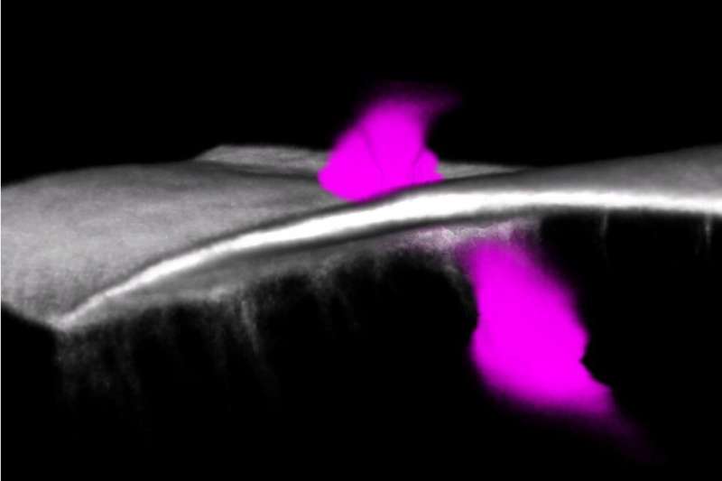 Zebrafish capture a 'window' on the cancer process