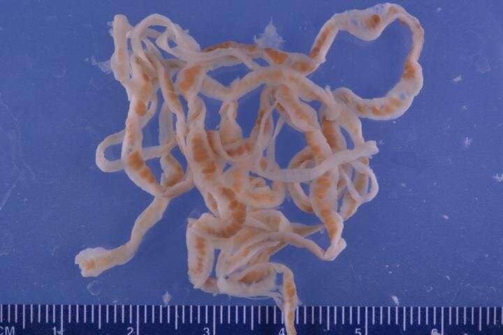 Scientists discovered mechanisms that protect tapeworms from being digested by their host