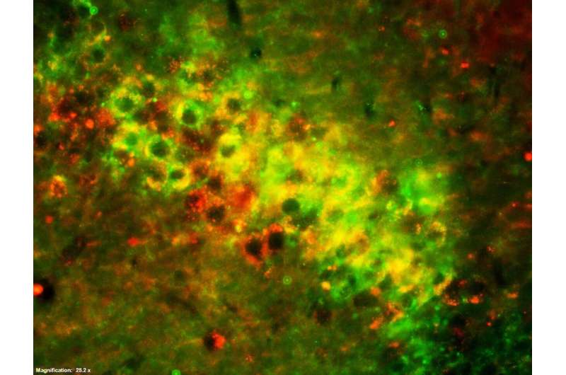 Researchers discover potential new therapeutic target for Alzheimer's disease