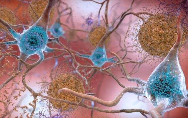 Researchers map protein-gene interactions involved in Alzheimer's disease