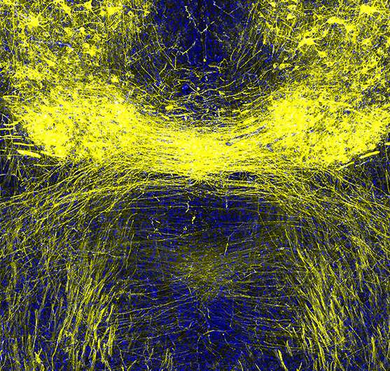 科学家们展示了微小的突变神经元天线损害脑连接