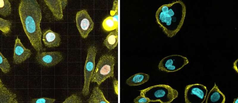 Researchers discover new cause of cell aging