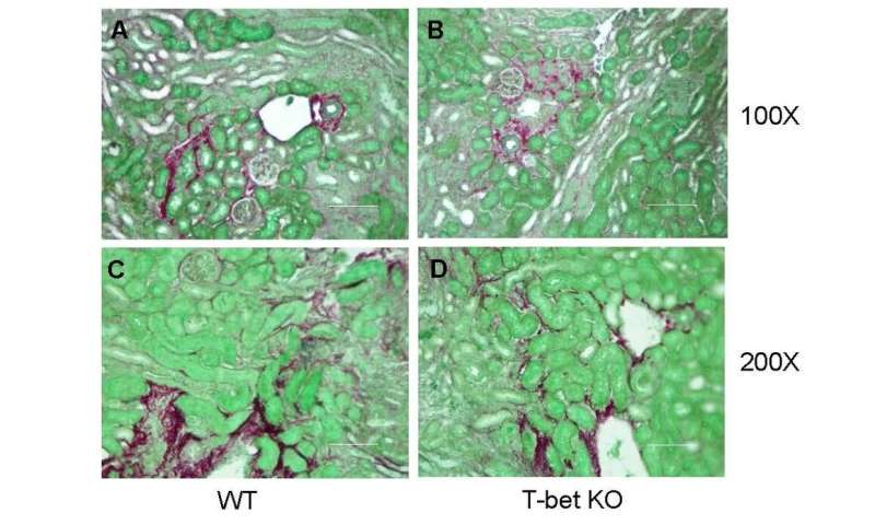 Scientists report new approach to reduce or prevent renal fibrosis