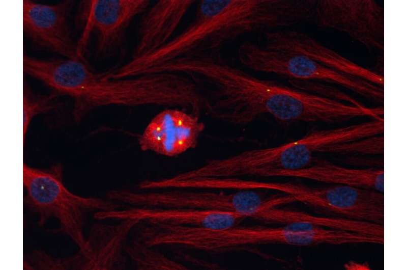 Researchers probe cell division defects to gain insight into cancer
