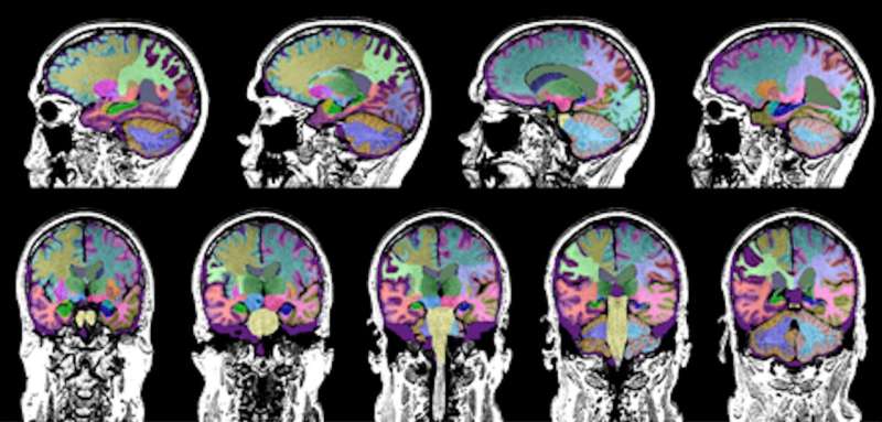 Study identifies brain injury as a cause of dementia in some older adults