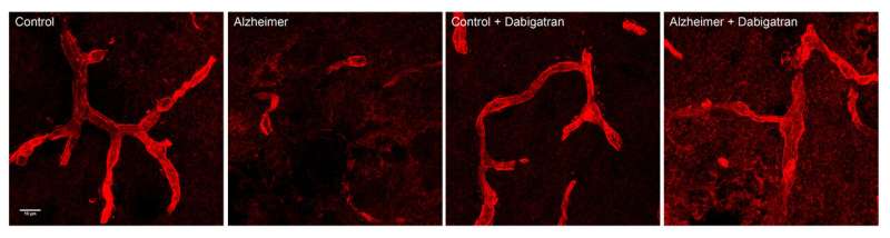 An oral anticoagulant delays the appearance of Alzheimer's disease in mice