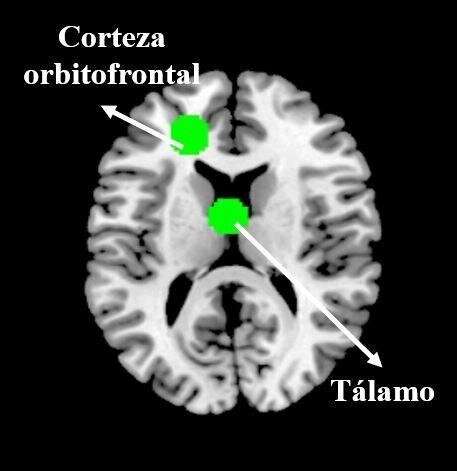 Brain activity of Spanish Popular Party voters triggered by rivals