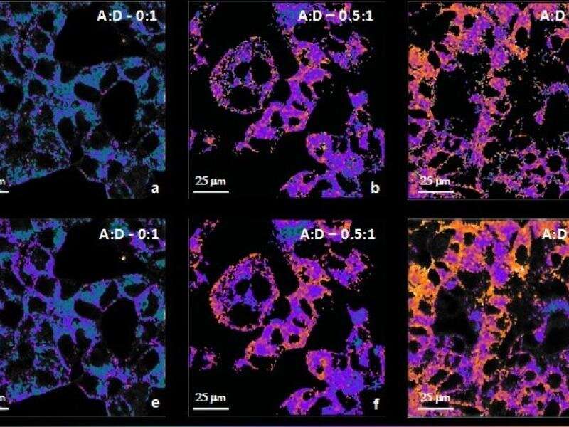 Deep Neural Network aims to improve imaging of cells
