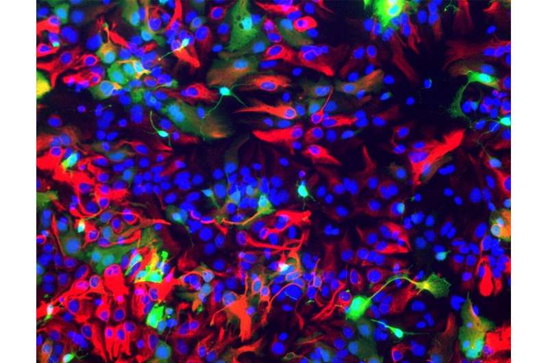 Discovery of the genetic 'conductor' of brain stem cells